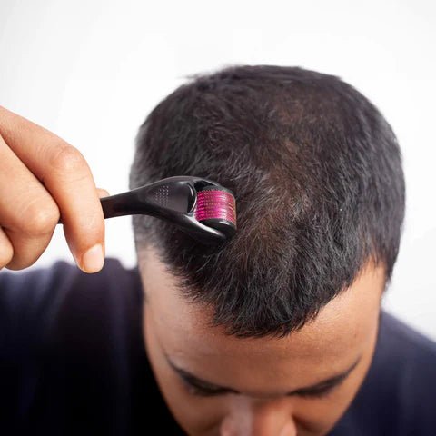 DERMAROLLER SYSTEM 0.5MM ALTA PRECISIÓN - SOLUCIONES CAPILARESDERMAROLLER SYSTEM 0.5MM ALTA PRECISIÓNSOLUCIONES CAPILARESFisico